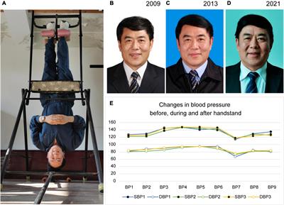 Case Report: Passive Handstand Promotes Cerebrovascular Elasticity Training and Helps Delay the Signs of Aging: A 40-Year Follow-Up Investigation